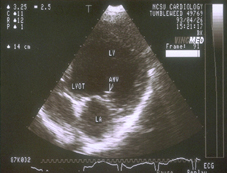 Ultrasonography